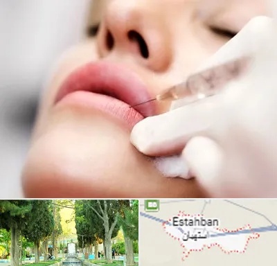 کلینیک تزریق ژل لب در استهبان