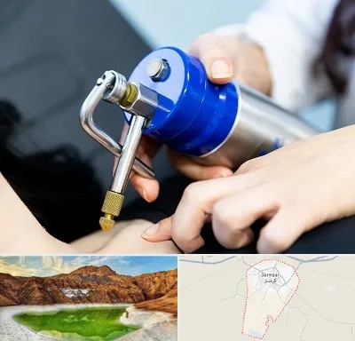 کرایوتراپی در گرمسار