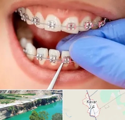 مرکز ارتودنسی دندان در کوار