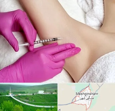 تزریق بوتاکس زیر بغل در مشگین شهر
