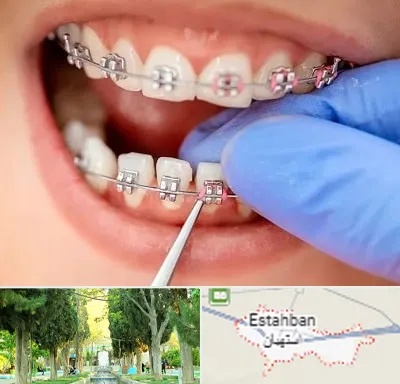 مرکز ارتودنسی دندان در استهبان
