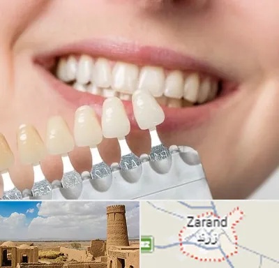 مرکز کامپوزیت دندان در زرند