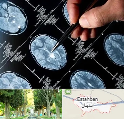 دکتر تشنج در استهبان