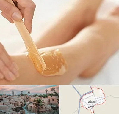 اپیلاسیون بدن در طبس
