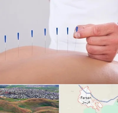 دکتر طب سوزنی در فارسان