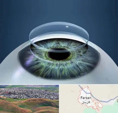 پیوند قرنیه در فارسان
