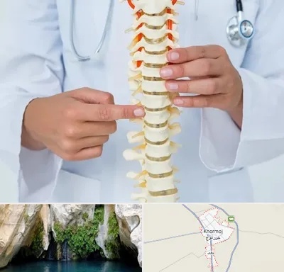 جراح ستون فقرات در خورموج