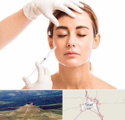 تزریق ژل گونه در تکاب