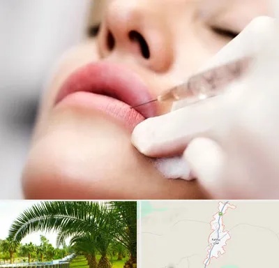کلینیک تزریق ژل لب در کهنوج