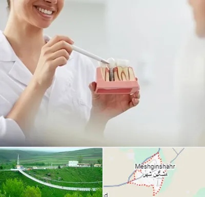 دکتر دندانساز در مشگین شهر