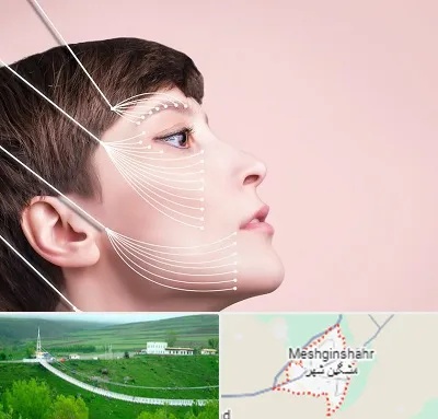 اندولیفت پیشانی در مشگین شهر