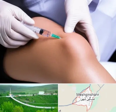 پلاسما درمانی PRP در مشگین شهر