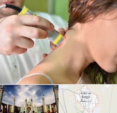 لیزر درمانی در آران و بیدگل