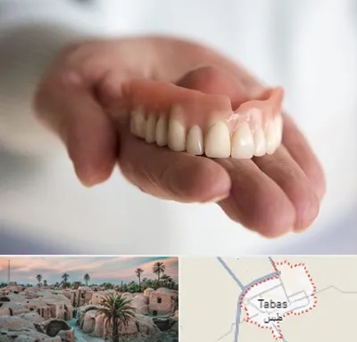 لیفت لثه با لیزر در طبس