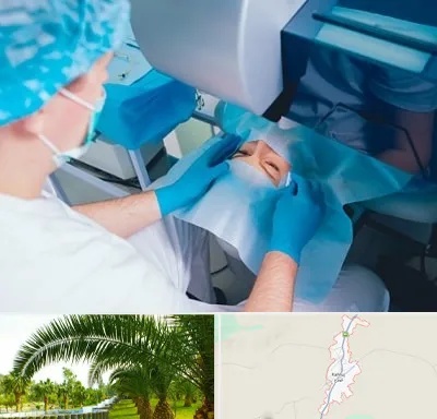 دکتر عمل لازک چشم در کهنوج