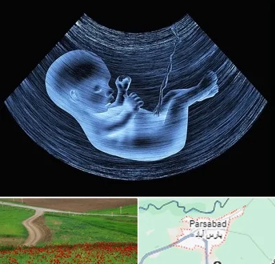 دکتر متخصص غربال گری در پارس آباد