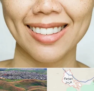عمل چال گونه در فارسان