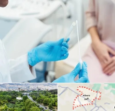 دکتر زگیل تناسلی HPV در البرز