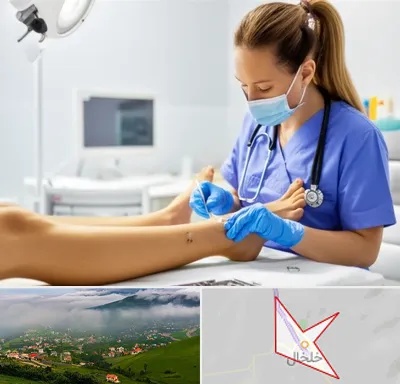 کارشناس زخم در خلخال