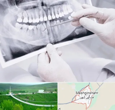 رادیولوژی دهان و دندان در مشگین شهر