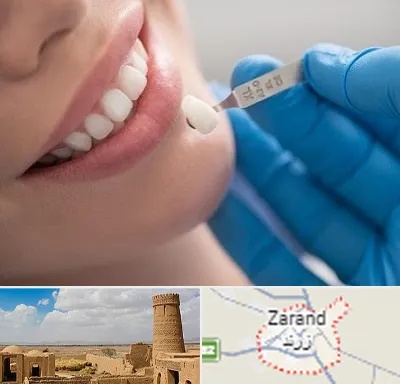 مرکز لمینت دندان در زرند