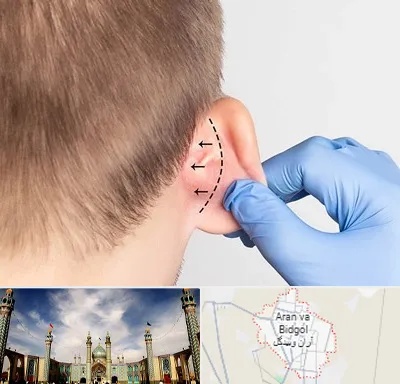 عمل زیبایی گوش در آران و بیدگل
