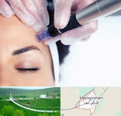 کلینیک مزوتراپی صورت در مشگین شهر