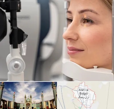 دکتر فوق تخصص چشم در آران و بیدگل