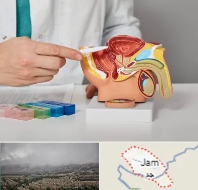 دکتر اورولوژی در جم