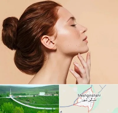 جراحی غبغب در مشگین شهر