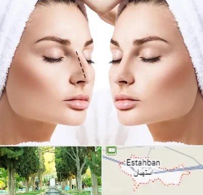 عمل بینی در استهبان