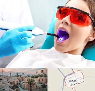 جراحی لثه با لیزر در طبس