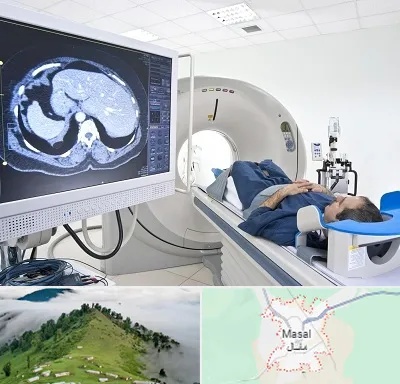 مرکز تصویر برداری پزشکی در ماسال