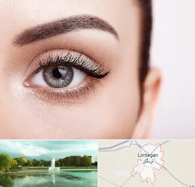 فوق تخصص عنبیه در لردگان