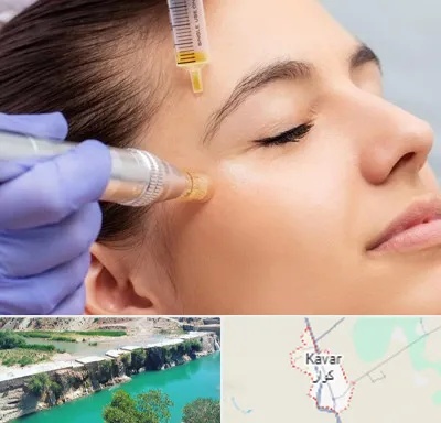 میکرونیدلینگ در کوار