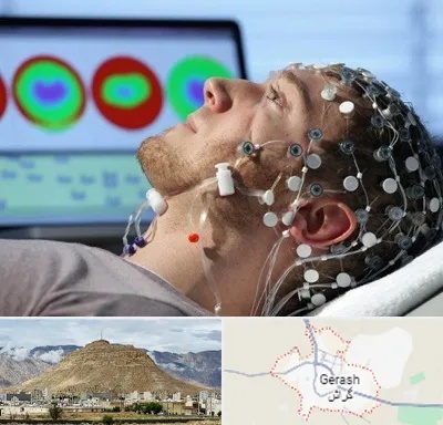 مرکز نوار مغز در گراش