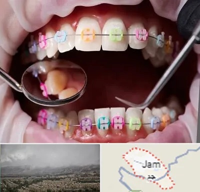 متخصص ارتودنسی در جم