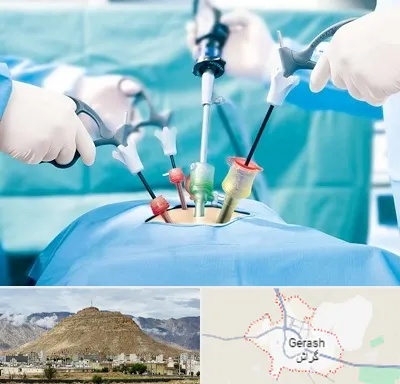 جراح فیبروم در گراش