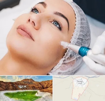 مزونیدلینگ در گرمسار