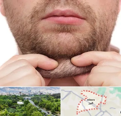 ساکشن غبغب در البرز