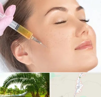آموزش تزریق ژل و بوتاکس در کهنوج
