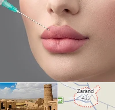 کلینیک ژل لب روسی در زرند