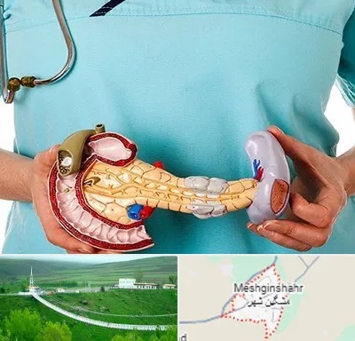 جراح سرطان لوزالمعده در مشگین شهر