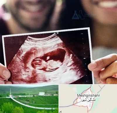 غربال گری در مشگین شهر