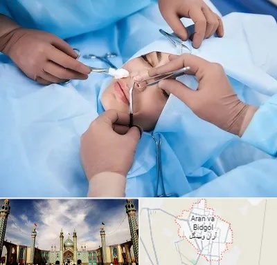 عمل بینی فانتزی در آران و بیدگل