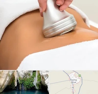 دستگاه لاغری در خورموج