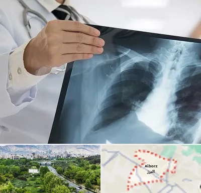 فوق تخصص ریه در البرز