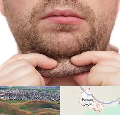 ساکشن غبغب در فارسان