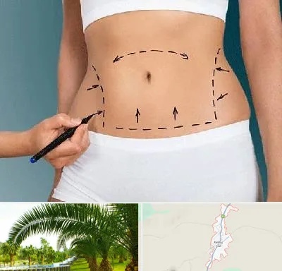 دکتر طب سنتی برای لاغری در کهنوج