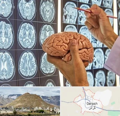 دکتر فوق تخصص جراح مغز و اعصاب در گراش